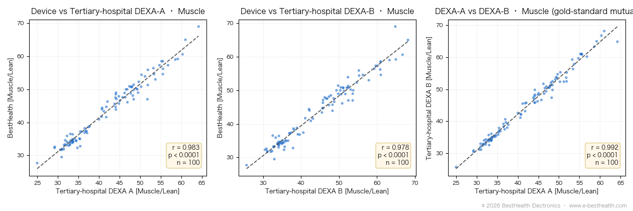 BestHealth vs two tertiary-hospital DEXA muscle mass, plus the mutual test between the two DEXA setups (n=100)